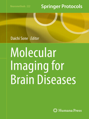 cover image of Molecular Imaging for Brain Diseases